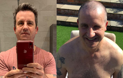 Tim before and after. Tim before and after.